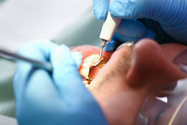 Best Walk-In Emergency Dental Services in Argyle, TX
