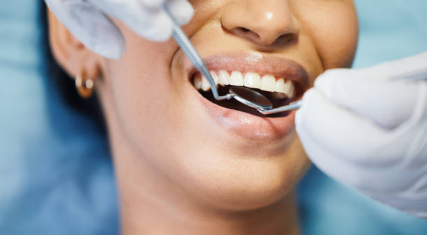 Best Knocked-Out Tooth (Avulsed Tooth) Treatment in Argyle, TX