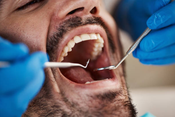 Best Emergency Dental Care for Sports Injuries in Argyle, TX