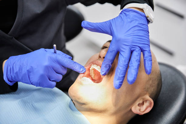 Best Emergency Wisdom Tooth Extraction in Argyle, TX